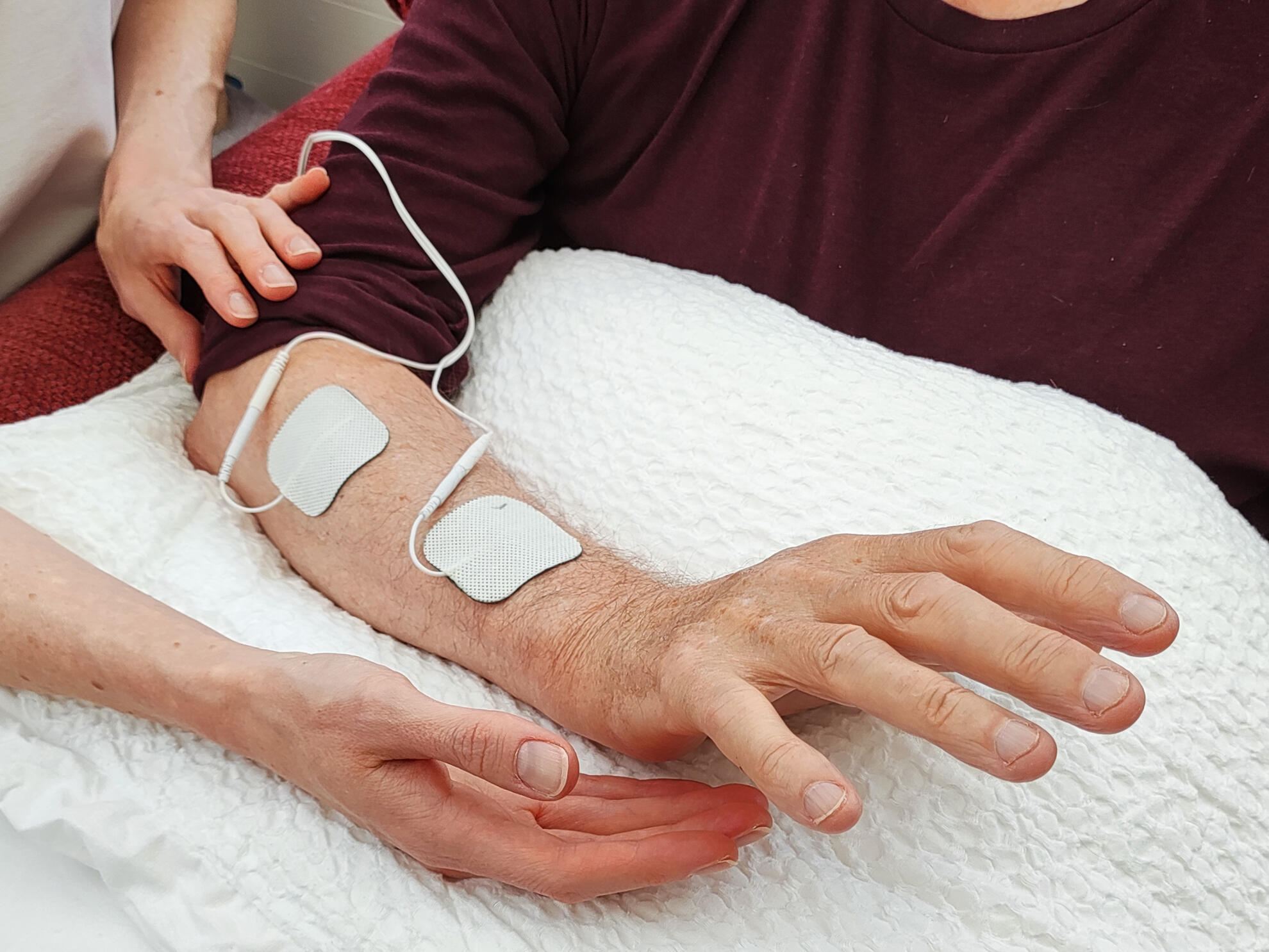 Physisotherapy with electrical stimulation Physiotherapist assisting a patient with hand and wrist rehabilitation using electrical stimulation pads during a therapy session